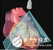 什么是声成像？三维超声成像技术原理_三维超声成像技术研究与应用