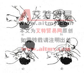 图9-16 口对口人工呼吸法