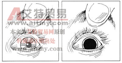 图7-3瞳孔放大的检测