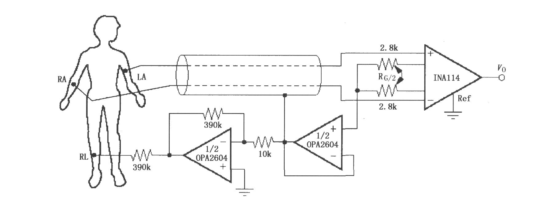 右腿驱动的ECG放大器(INA114)