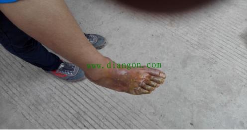 一起临时用电工程造成人员触电事故简析 